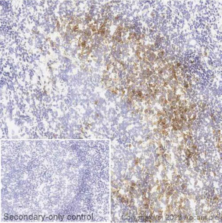 Immunohistochemistry (Frozen sections) - Anti-PD1 antibody [NAT105] (AB52587)