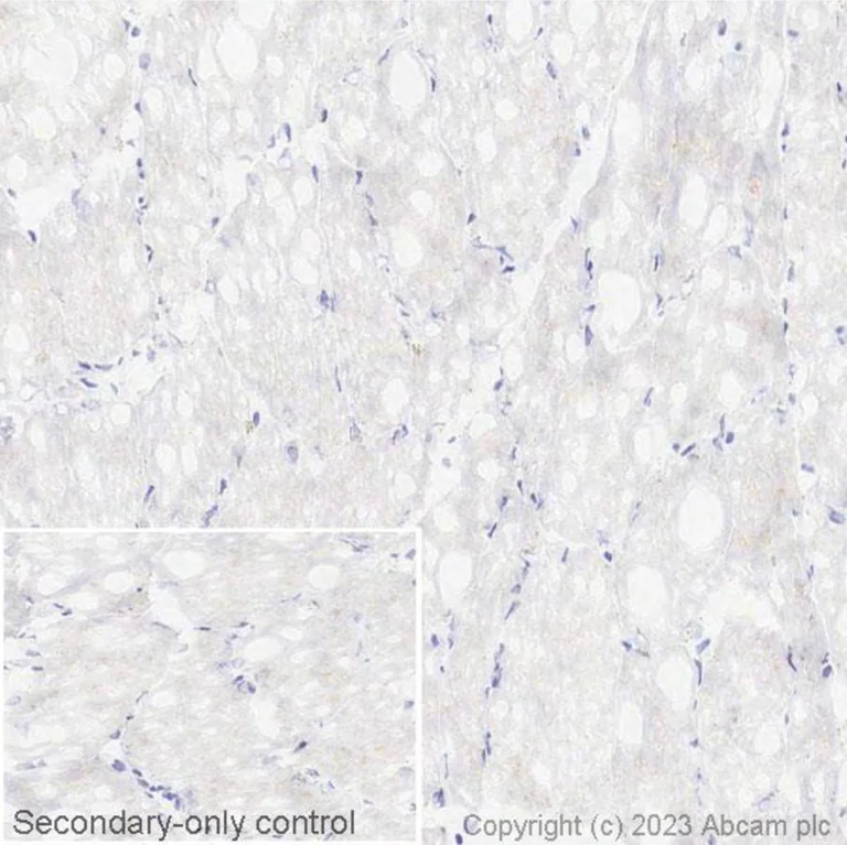Immunohistochemistry (Frozen sections) - Anti-PD1 antibody [NAT105] (AB52587)