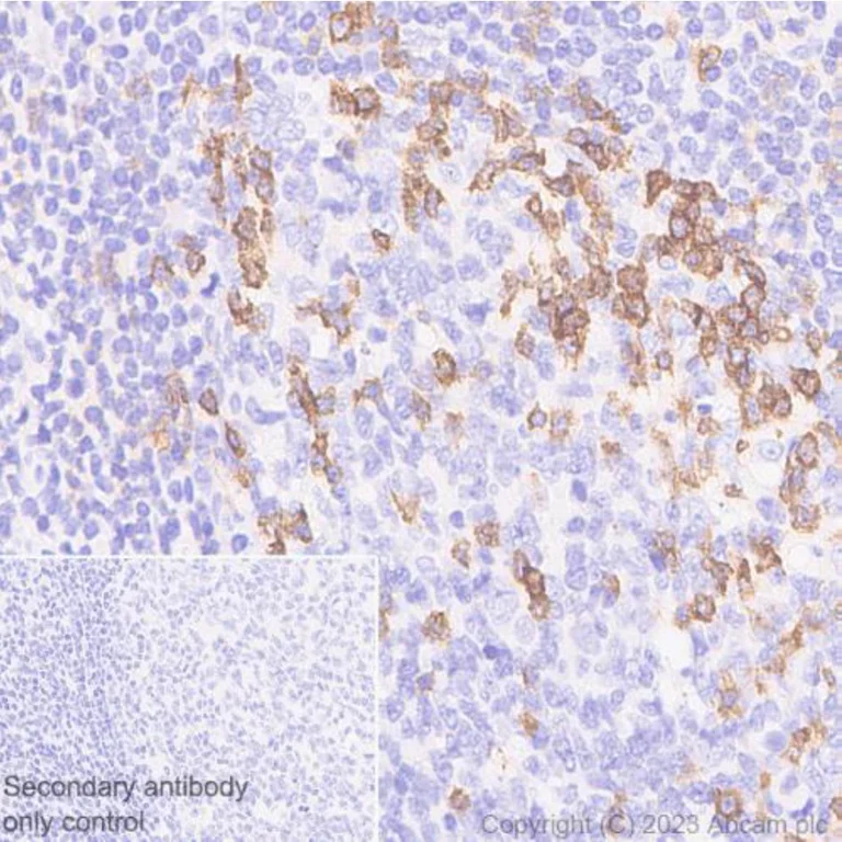 Immunohistochemistry (Formalin/PFA-fixed paraffin-embedded sections) - Anti-PD1 antibody [NAT105] - BSA and Azide free (AB201811)