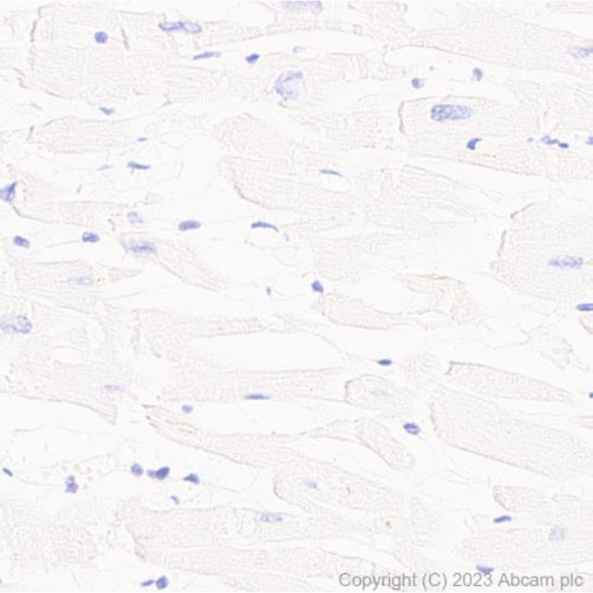 Immunohistochemistry (Formalin/PFA-fixed paraffin-embedded sections) - Anti-PD1 antibody [NAT105] - BSA and Azide free (AB201811), expandable thumbnail