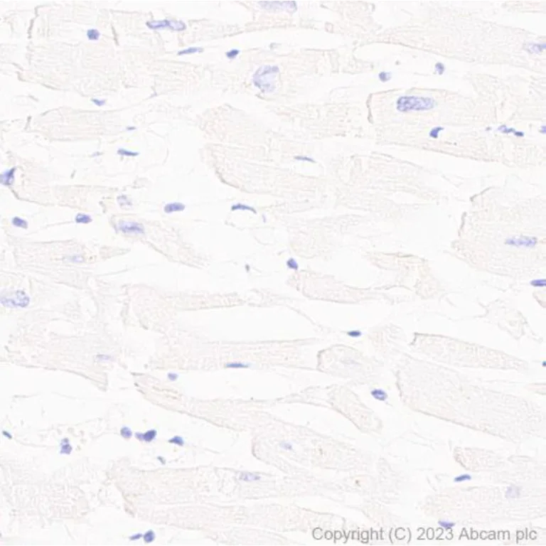 Immunohistochemistry (Formalin/PFA-fixed paraffin-embedded sections) - Anti-PD1 antibody [NAT105] - BSA and Azide free (AB201811)