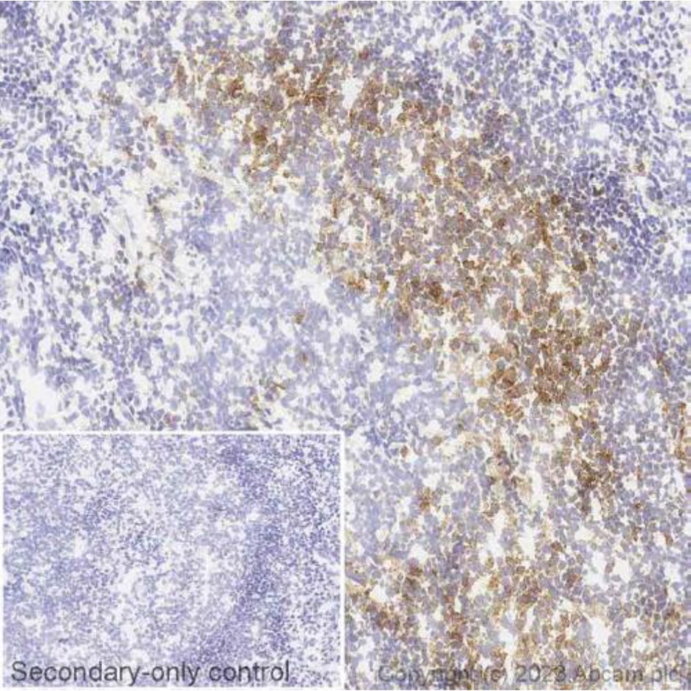 Immunohistochemistry (Frozen sections) - Anti-PD1 antibody [NAT105] - BSA and Azide free (AB201811), expandable thumbnail