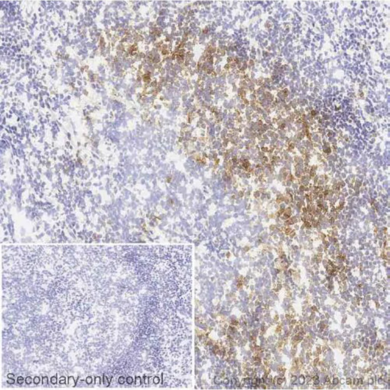 Immunohistochemistry (Frozen sections) - Anti-PD1 antibody [NAT105] - BSA and Azide free (AB201811)