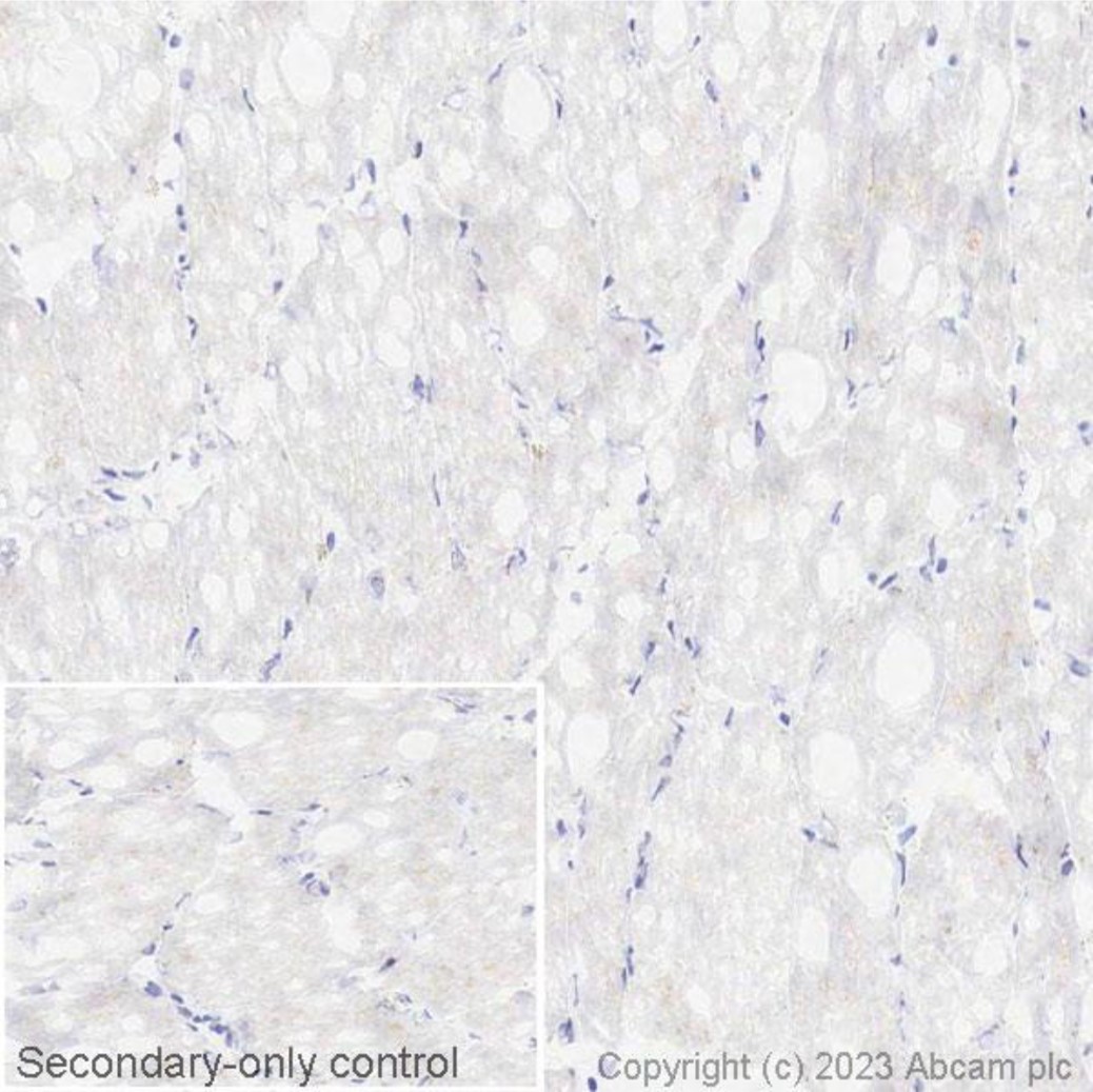 Immunohistochemistry (Frozen sections) - Anti-PD1 antibody [NAT105] - BSA and Azide free (AB201811), expandable thumbnail