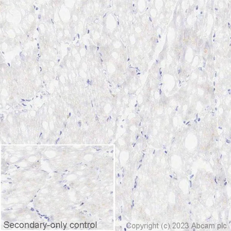Immunohistochemistry (Frozen sections) - Anti-PD1 antibody [NAT105] - BSA and Azide free (AB201811)