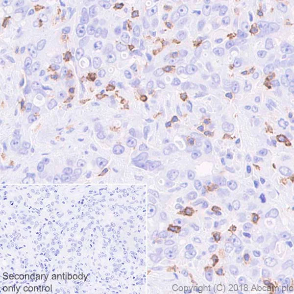 Immunohistochemistry (Formalin/PFA-fixed paraffin-embedded sections) - Anti-PD1 antibody [NAT105] - Rabbit IgG (Chimeric) (AB216352)