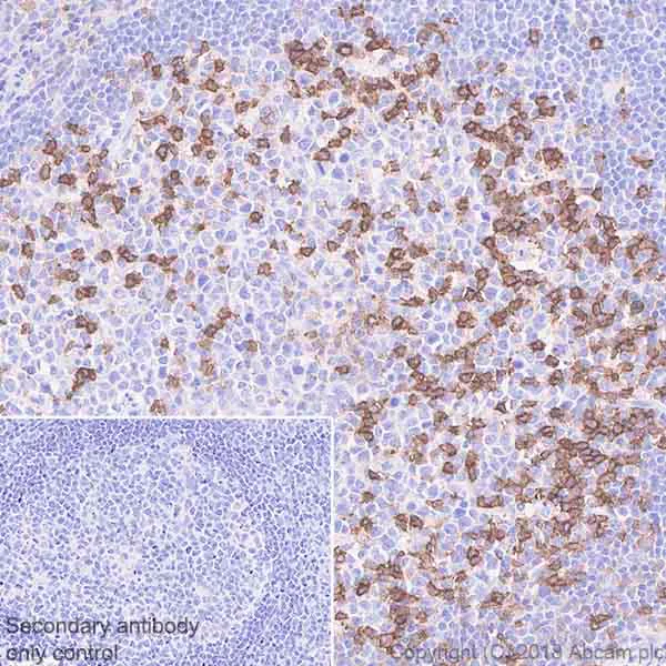 Immunohistochemistry (Formalin/PFA-fixed paraffin-embedded sections) - Anti-PD1 antibody [NAT105] - Rabbit IgG (Chimeric) - BSA and Azide free (AB233091)