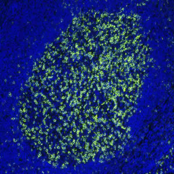 Immunohistochemistry (Formalin/PFA-fixed paraffin-embedded sections) - PD1 Antibody Panel (EPR4877(2), SP269, CAL20, NAT105, NAT105-EPR21106) (AB252192), expandable thumbnail