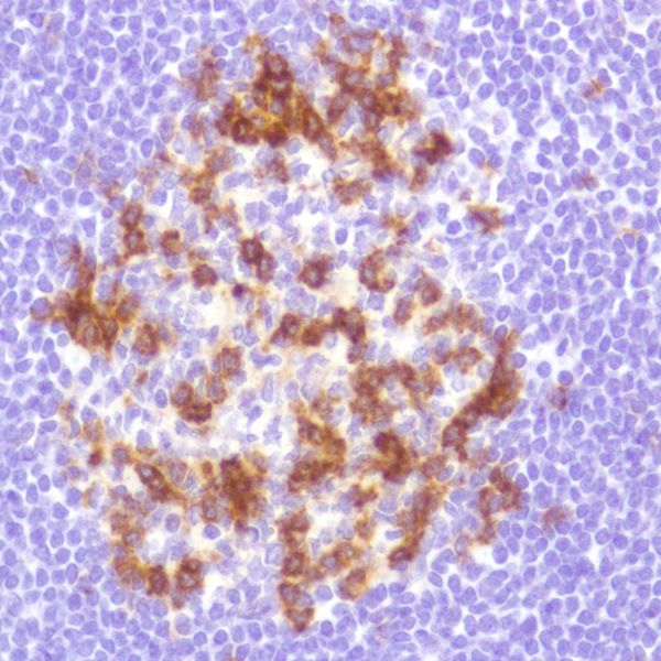 Immunohistochemistry (Formalin/PFA-fixed paraffin-embedded sections) - PD1 Antibody Panel (EPR4877(2), SP269, CAL20, NAT105, NAT105-EPR21106) (AB252192), expandable thumbnail