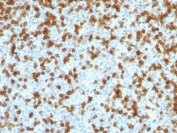 Immunohistochemistry (Formalin/PFA-fixed paraffin-embedded sections) - Anti-PD1 antibody [PDCD1/1410R] (AB218475)