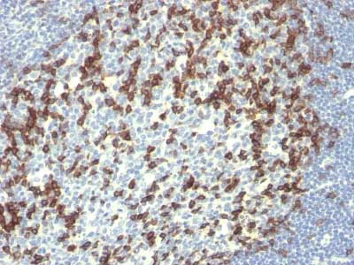 Immunohistochemistry (Formalin/PFA-fixed paraffin-embedded sections) - Anti-PD1 antibody [PDCD1/922] - BSA and Azide free (AB215847)
