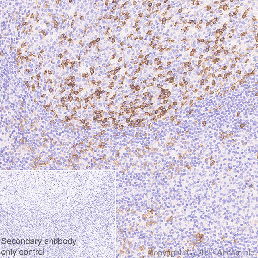 Immunohistochemistry (Formalin/PFA-fixed paraffin-embedded sections) - Anti-PD1 antibody [RM1033] (AB309363), expandable thumbnail