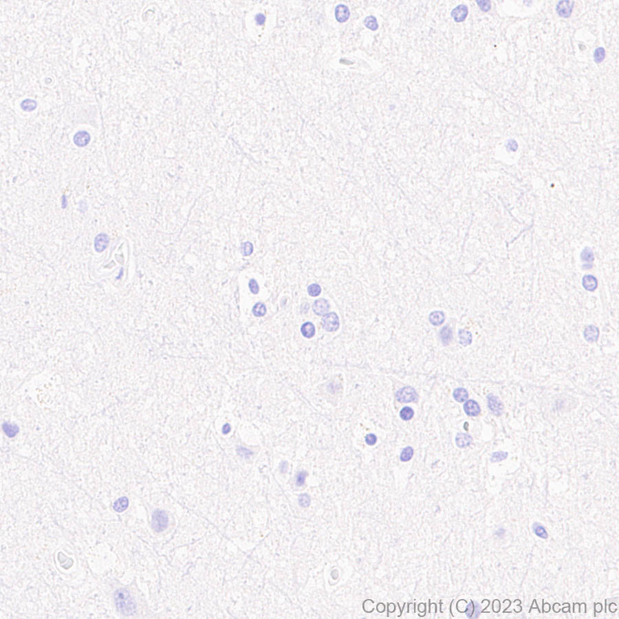 Immunohistochemistry (Formalin/PFA-fixed paraffin-embedded sections) - Anti-PD1 antibody [RM1033] (AB309363), expandable thumbnail