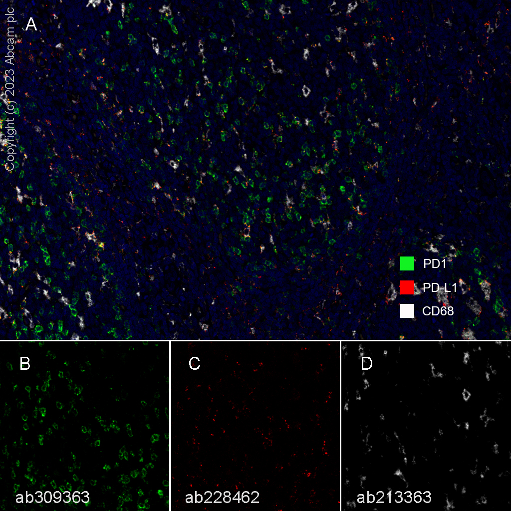 Multiplex immunohistochemistry - Anti-PD1 antibody [RM1033] (AB309363), expandable thumbnail