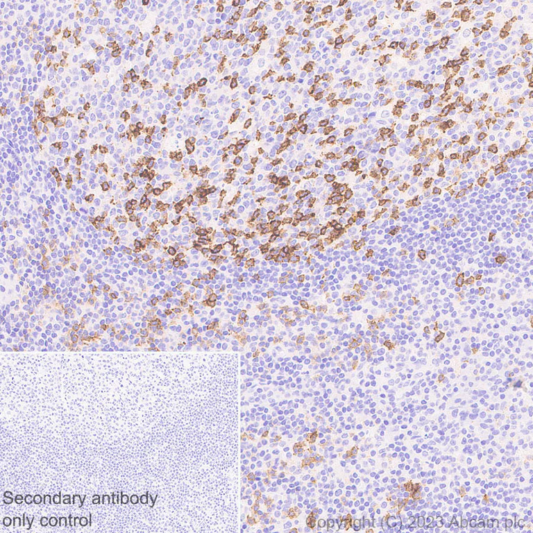 Immunohistochemistry (Formalin/PFA-fixed paraffin-embedded sections) - Anti-PD1 antibody [RM1033] - BSA and Azide free (AB309364)