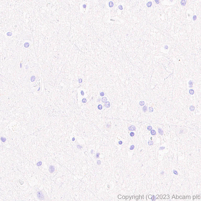Immunohistochemistry (Formalin/PFA-fixed paraffin-embedded sections) - Anti-PD1 antibody [RM1033] - BSA and Azide free (AB309364)
