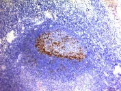 Immunohistochemistry (Formalin/PFA-fixed paraffin-embedded sections) - Anti-PD1 antibody [SPM597] (AB218474)