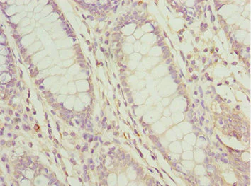 Immunohistochemistry (Formalin/PFA-fixed paraffin-embedded sections) - Anti-PDCD2L antibody (AB229978)