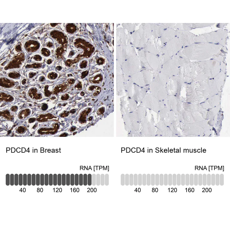 Immunohistochemistry (Formalin/PFA-fixed paraffin-embedded sections) - Anti-PDCD4 Antibody (AB327166)