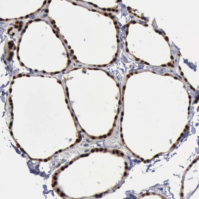 Immunohistochemistry (Formalin/PFA-fixed paraffin-embedded sections) - Anti-PDCD4 Antibody (AB327166)