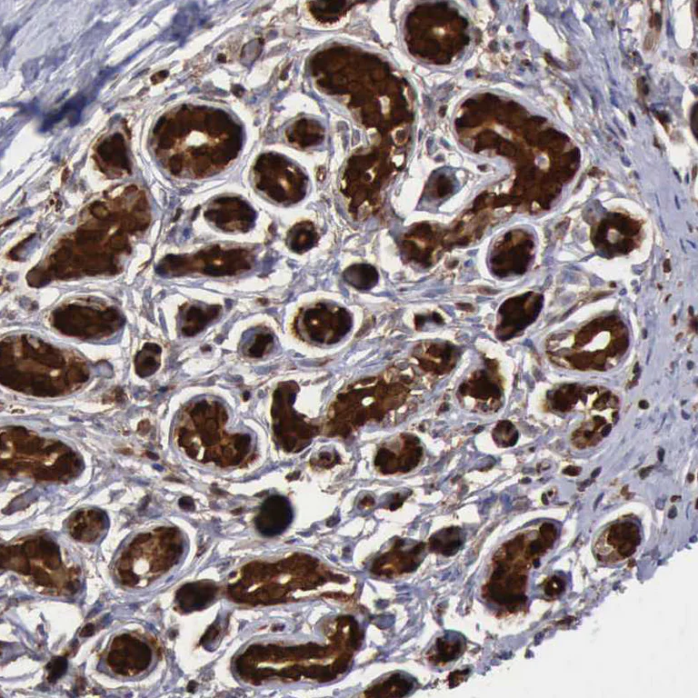 Immunohistochemistry (Formalin/PFA-fixed paraffin-embedded sections) - Anti-PDCD4 Antibody (AB327166)