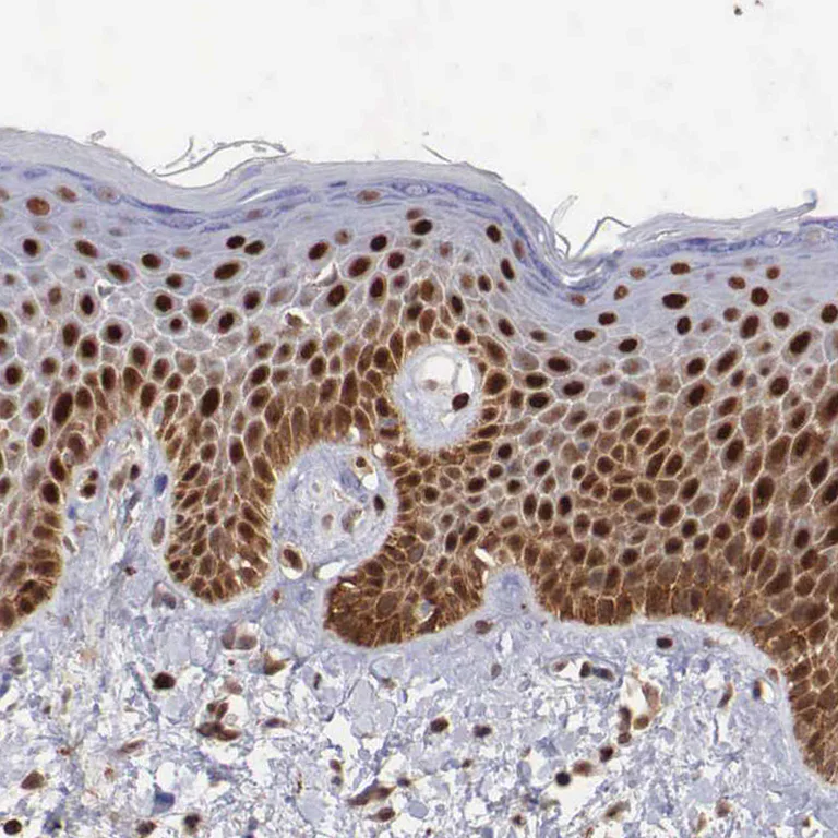 Immunohistochemistry (Formalin/PFA-fixed paraffin-embedded sections) - Anti-PDCD4 Antibody (AB327166)