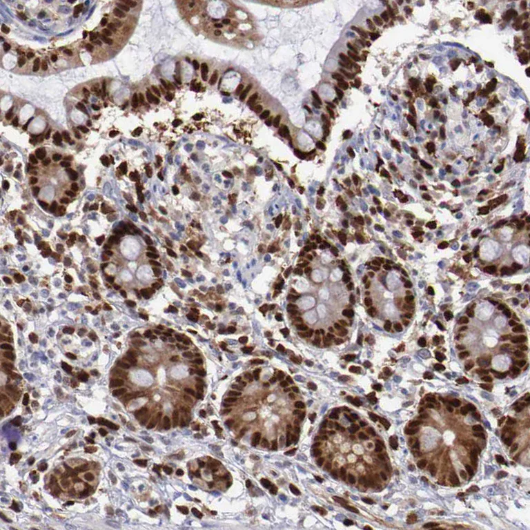 Immunohistochemistry (Formalin/PFA-fixed paraffin-embedded sections) - Anti-PDCD4 Antibody (AB327166)