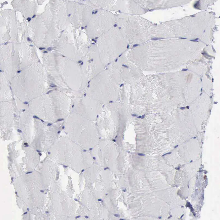 Immunohistochemistry (Formalin/PFA-fixed paraffin-embedded sections) - Anti-PDCD4 Antibody (AB327166)