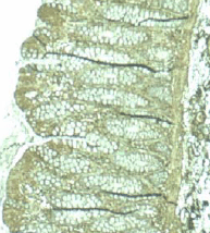 Immunohistochemistry (Formalin/PFA-fixed paraffin-embedded sections) - Anti-PDCD4 antibody (AB51495)