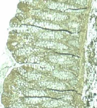 Immunohistochemistry (Formalin/PFA-fixed paraffin-embedded sections) - Anti-PDCD4 antibody (AB51495)
