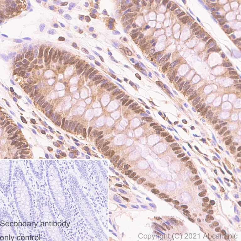 Immunohistochemistry (Formalin/PFA-fixed paraffin-embedded sections) - Anti-PDCD4 antibody [EPR3431] - BSA and Azide free (AB247512)