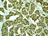 Immunohistochemistry (Formalin/PFA-fixed paraffin-embedded sections) - Anti-PDCD4 antibody [EPR3432] (AB79405)