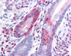 Immunohistochemistry (Formalin/PFA-fixed paraffin-embedded sections) - Anti-PDCD4 (phospho S457) antibody [9G6] (AB105998)