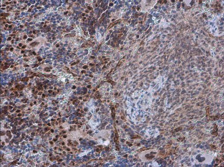 Immunohistochemistry (Formalin/PFA-fixed paraffin-embedded sections) - Anti-PDCD4 (phospho S457) antibody (AB226849)