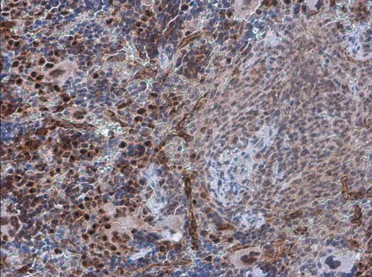 Immunohistochemistry (Formalin/PFA-fixed paraffin-embedded sections) - Anti-PDCD4 (phospho S457) antibody (AB226849)