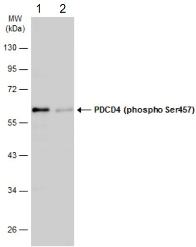 Western blot - Anti-PDCD4 (phospho S457) antibody (AB226849)