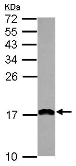 Western blot - Anti-PDCD5 antibody (AB126213)