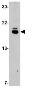 Western blot - Anti-PDCD5 antibody (AB83958)