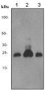 Western blot - Anti-PDCD6/ALG-2 antibody [EP3259] (AB109181)