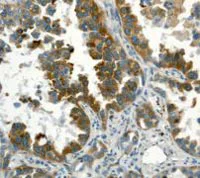 Immunohistochemistry (Formalin/PFA-fixed paraffin-embedded sections) - Anti-PDCD6/ALG-2 antibody [EP3259] - BSA and Azide free (AB240941)