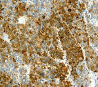 Immunohistochemistry (Formalin/PFA-fixed paraffin-embedded sections) - Anti-PDCD6/ALG-2 antibody [EP3259] - BSA and Azide free (AB240941)