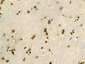 Immunohistochemistry (Formalin/PFA-fixed paraffin-embedded sections) - Anti-PDCD7 antibody [EPR8231] (AB131258)