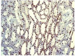 Immunohistochemistry (Formalin/PFA-fixed paraffin-embedded sections) - Anti-PDCD7 antibody [EPR8231] (AB131258)