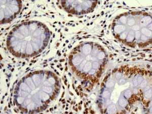 Immunohistochemistry (Formalin/PFA-fixed paraffin-embedded sections) - Anti-PDCD7 antibody [EPR8231] (AB131258)