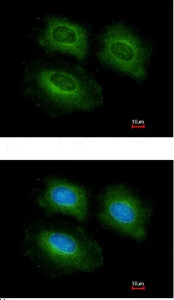 Immunocytochemistry/ Immunofluorescence - Anti-PDE10A antibody - C-terminal (AB151454)