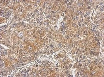 Immunohistochemistry (Formalin/PFA-fixed paraffin-embedded sections) - Anti-PDE10A antibody - C-terminal (AB151454)
