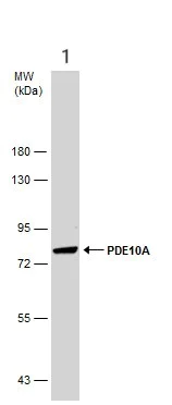 Western blot - Anti-PDE10A antibody - C-terminal (AB151454)