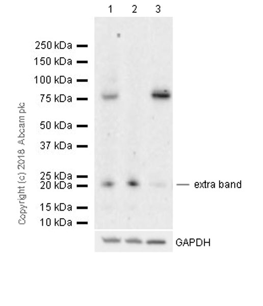 Western blot - Anti-PDE10A antibody [EPR22383] (AB227829)