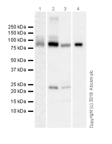 Western blot - Anti-PDE10A antibody [EPR22383] (AB227829)