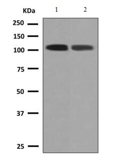 Western blot - Anti-PDE2A antibody [EPR9688] (AB140650)